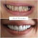 Slider image (7) FMS Dental Hospital - Kukatpally